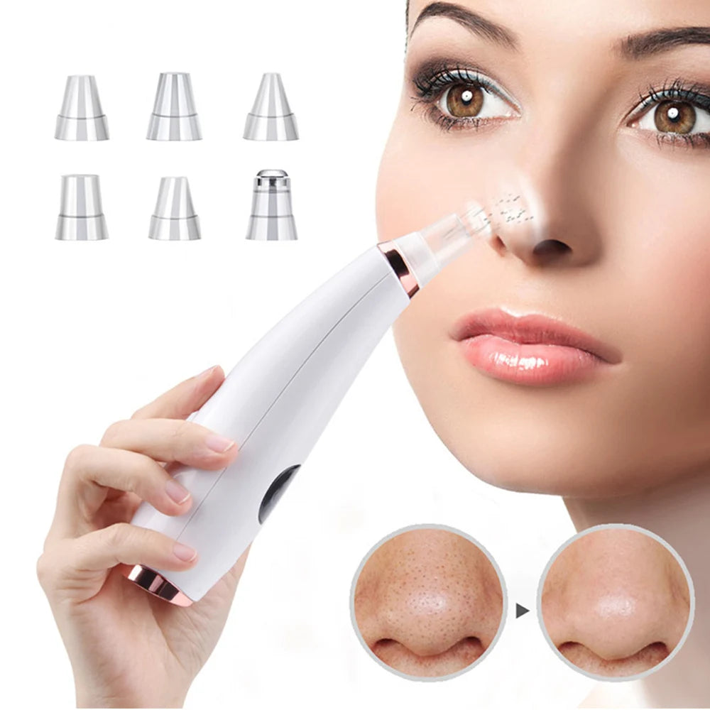 Electric Blackhead