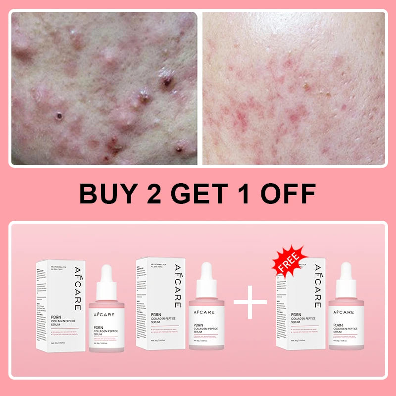 Collagen Peptide Facial