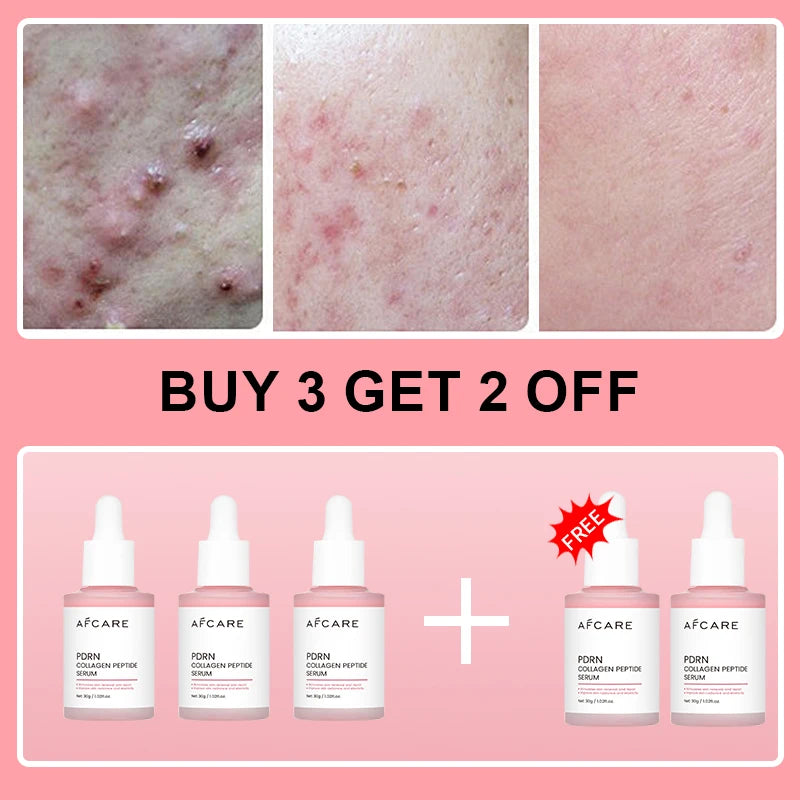 Collagen Peptide Facial
